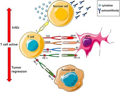 Immune Check Point Inhibitors and Immune-Related Adverse Events in Small Cell Lung Cancer